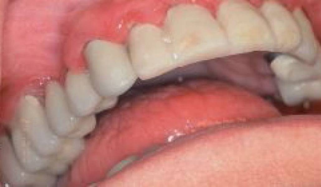 465d049c4d1f35a21a2610fa93fc004e