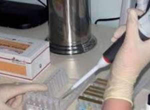 Здоровый образ жизни против рака: советы (видеоматериал)