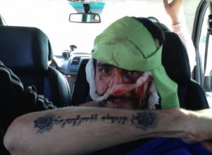 Journalist did not receive receive life-threatening injuries -armtimes.com