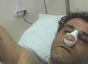 Избитый активист коснется конфликта между РПА и ППА