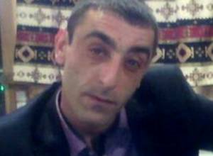 Man beaten up by Armenian Governor’s son loses vision in right eye