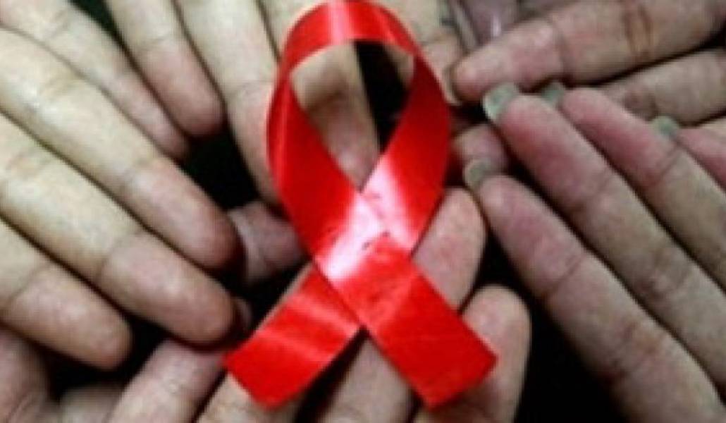 Գիտնականները հայտնաբերել են ՄԻԱՎ-ի նոր՝ ավելի վտանգավոր եւ ավելի վարակիչ շտամ