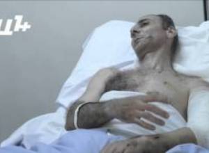 Доброволец рассказывает о полученных ранениях