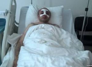 Derenik Malkhasyan witnessed attack on Artsakh lawmaker