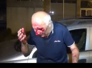 Clashes between policemen and citizens on Khorenatsi street: there are injured people