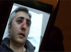 Policemen hit Arabist on head with shoes: “Ani”