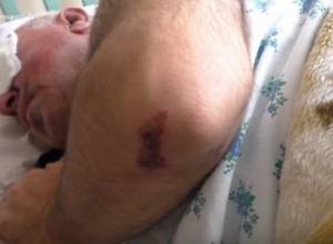 Criminal Etchmiadzin: “One held from behind, another bit the shoulder”