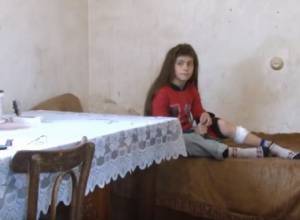 Թափառող շունը կծել է երեխային, բժիշկն ասել է՝ սպասեք, կանցնի