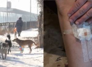 Group of dogs attack woman in Gyumri