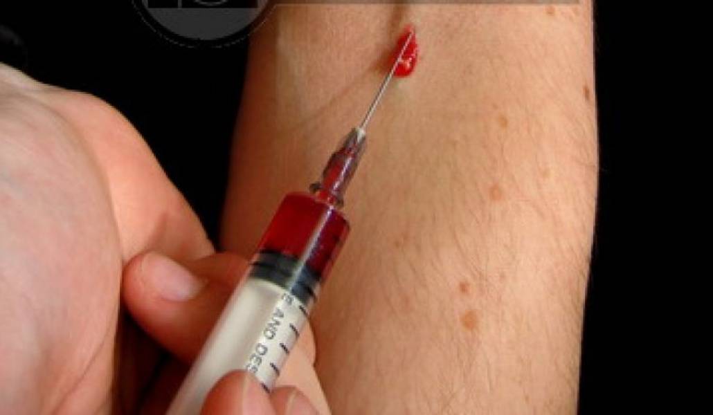 bad4bc77ab6ba0c3a173eaf329e3d10f