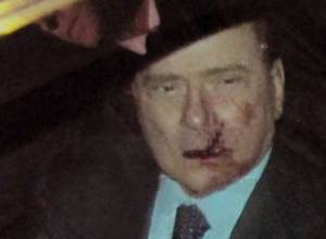 Премьер-министр доставлен в больницу