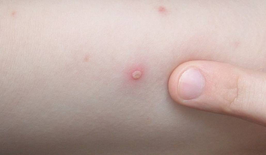 19c22e584d3ecd48b93b4d10455c461f