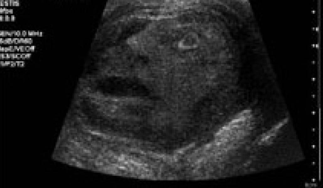 b1c9049280fa5cff1acc8df5e53f371c