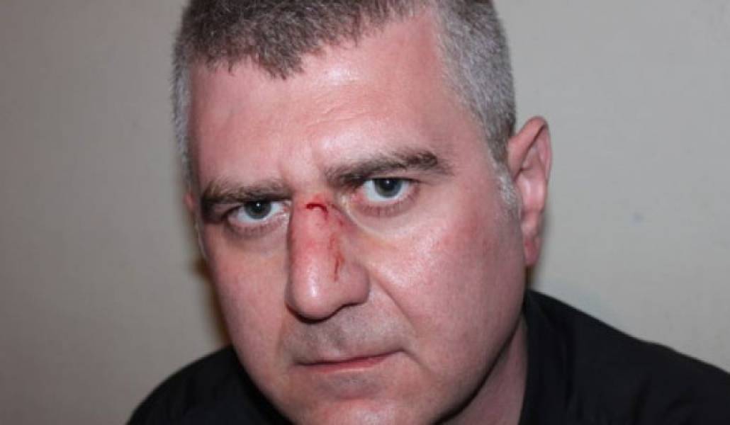 d8347bdfcbf1f885daa2b35412d8f9d2