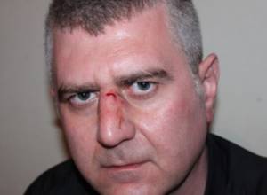 Кандидатам от АНК выданы направления