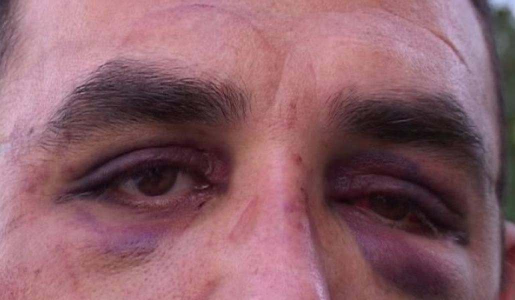 8d24cd4b2f3bcbb3bca3f762fc8d8a5f