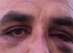 "Полицейские даже не выстрелили в воздух"