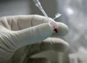 87% зараженных работоспособные люди