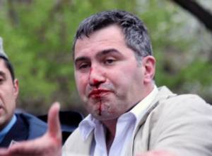 А. Мартиросян:  Хорошо, что не стали обвиняемыми