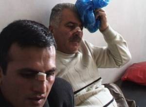 Makeyan and his son beaten up