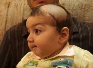 Save 11-month-old Arman's life!