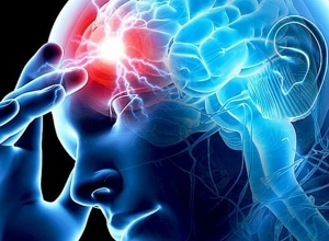 Инсульт головного мозга – вторая причина смертности: Министерство здравоохранения