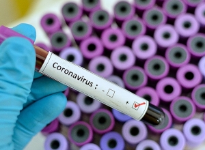 Why regional hospitals not provided with diagnostic tests of coronavirus?