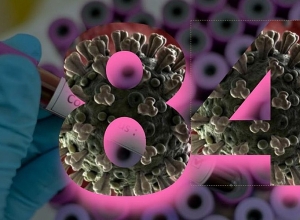 Number of people infected with coronavirus in Armenia reachs 84