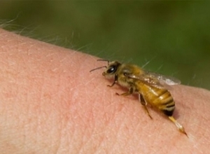 Շիրակի մարզում մեղվի խայթոցից տղամարդ է մահացել