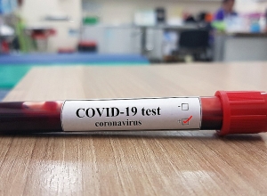 797 patients currently receiving treatment for coronavirus