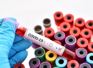 В Арцахе подтверждено 4 новых случая коронавируса