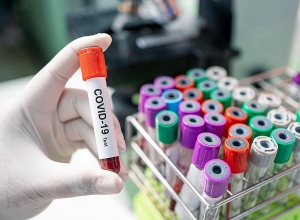 Случаи коронавируса в Армении сегодня