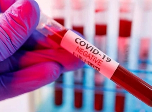 «Նոայի» ֆուտբոլիստների COVID-19 թեստերը բացասական են եղել