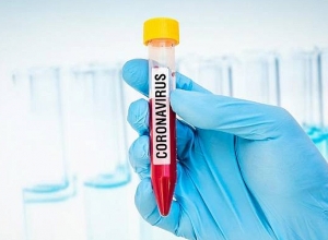 В инфекционной больнице Гюмри лечатся 76 жителей Ширакской области, больных коронавирусом