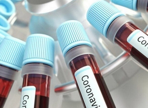 12 new deaths of coronavirus and 1013 recovered cases registered