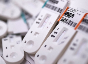 Ինչո՞ւ է կորանավիրուսի այդպիսի բարձր ցուցանիշ գրանցվել այսօր