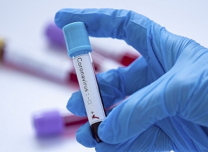 В Арцахе еще 3 человека преодолели коронавирус