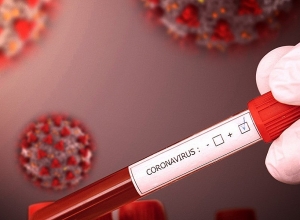 31 new cases of coronavirus confirmed in Gegharkunik