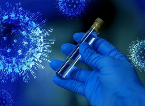 ԱՄՆ ՄԶԳ-ն և ԱՀԿ-ն ամփոփում են ՀՀ Առողջապահության նախարարությանը տրամադրվող աջակցության ծրագիրը