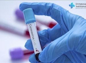 715 new cases of coronavirus confirmed