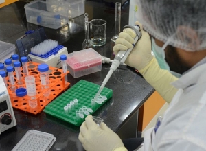 Կորոնավիրուսից մահանում է վարակվածների մոտավորապես 1.2 տոկոսն աշխարհում