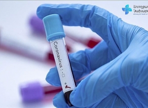 3 новых случая смерти – 1 женщина, 2 мужчин