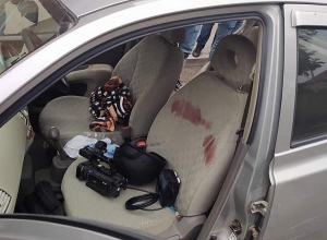 «Մեկին այս պահին վիրահատում են». մանրամասներ՝ Արցախում վիրավորված լրագրողների մասին. լուսանկարներ