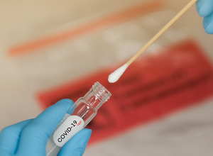 Չի բացառվում՝  հաջորդ տարվանից COVID-19 թեստավորումը դառնա առօրյա կյանքի մաս
