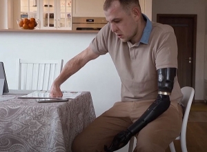 Ճարտարագետը փորձում է արհեստական բանականության միջոցով ավելի դյուրին դարձնել պրոթեզների օգտագործումը