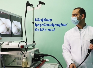 Колоректальный рак - третий по распространенности рак у взрослых в мире