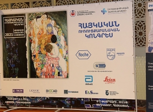 Պետք է ձգտել նրան, որ Հայաստանում քաղցկեղը չլինի դատավճիռ. նախարար