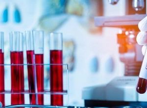 Արցախում կորոնավիրուսային հիվանդության նոր դեպք չի գրանցվել