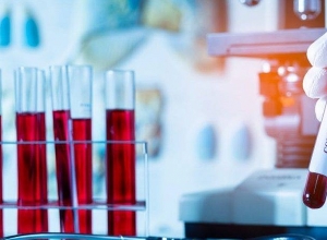 Արցախում հաստատվել է կորոնավիրուսային հիվանդության 4 նոր դեպք