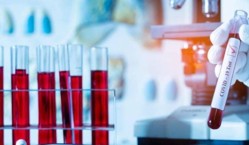 152776538_2818126425127247_3112753821985537083_n